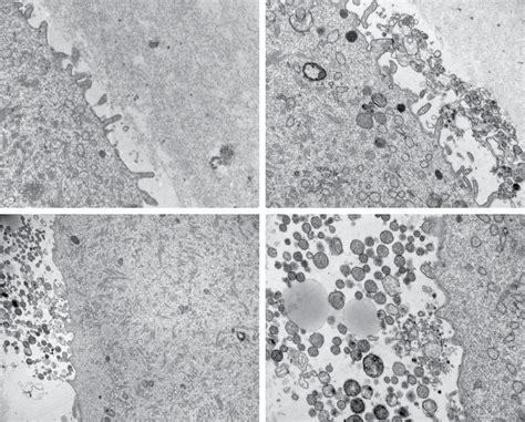 Ultrastructure of perivitelline space in wild type and hyh MII oocytes.... | Download Scientific ...