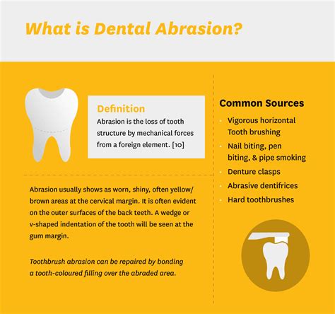 The Dentist's Guide to Tooth Erosion, Attrition, Abrasion & Abfraction