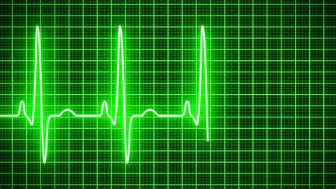 Animation of an Electrocardiography (ecg) Stock Footage Video (100% ...