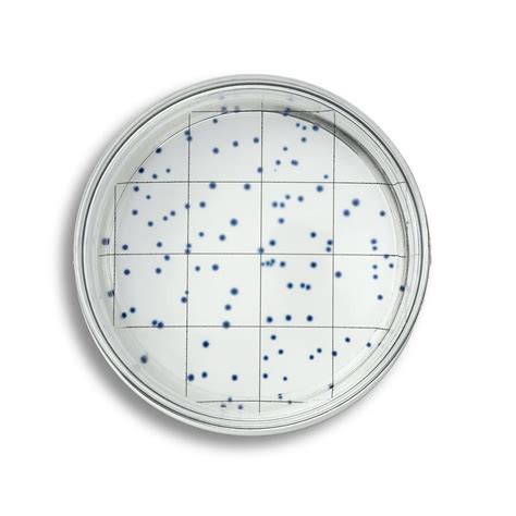 A New Solution for Heterotrophic Plate Count Testing | Lab Manager