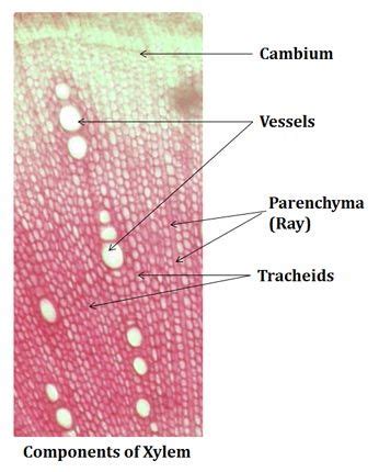 Diagram Of Xylem Tracheids