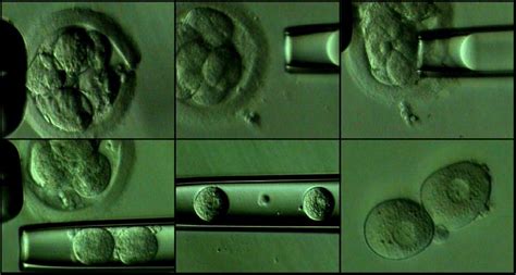 b. Blastomere biopsy procedure. | Download Scientific Diagram