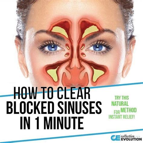 Best 25+ Blocked nose ideas on Pinterest | Sick tea image, Tea image ...