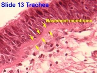 Basement membrane