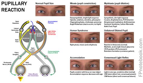 Mydriasis