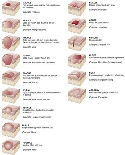 Types of Skin Lesions : coolguides | Skin anatomy, Wounds nursing, Skin disease pictures