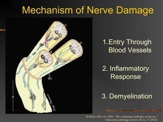 Leprosy | PPT