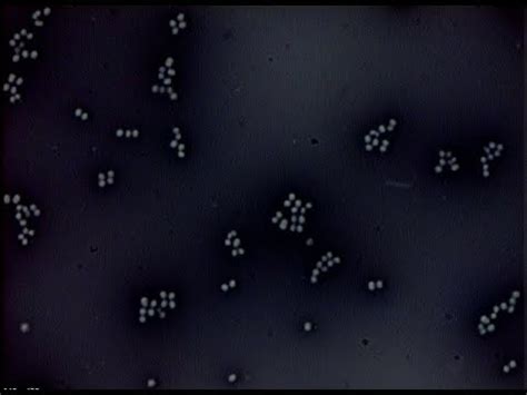 What Is Negative Staining