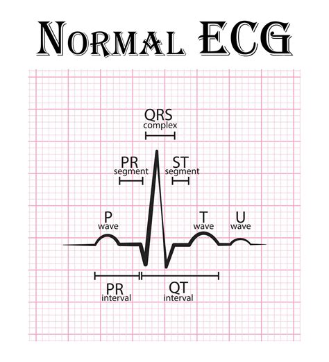 Your Apple Watch can now record your ECG – but what does that mean and can you trust it?