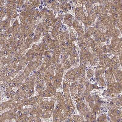 Phenylalanine Hydroxylase Antibody (NBP1-80917): Novus Biologicals