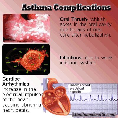 17 Best images about Asthma on Pinterest | Asthma symptoms, Medicine ...