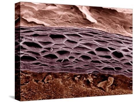 Cross Section of Human Skin Showing the Stratum Corneum Layer of the Epidermis Photographic ...