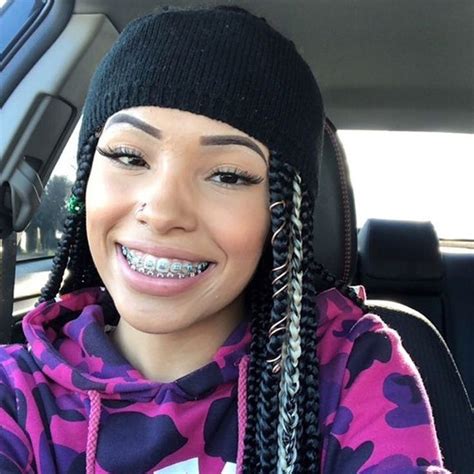 Pinterest: @Tasty_Doll🍭 Follow for more | Braces girls, Cute braces colors, Cute braces