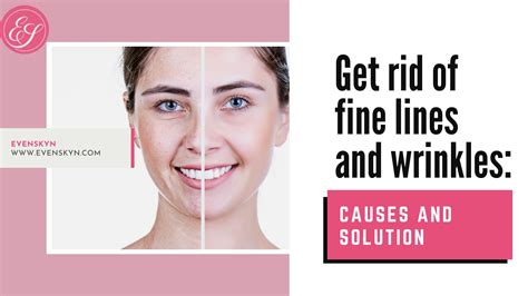 Get rid of fine lines and wrinkles: Causes and solution by EvenSkyn® - Issuu