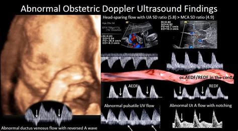 Fetal ultrasound heart rate | Ultrasound, Obstetric ultrasound, Ultrasound sonography