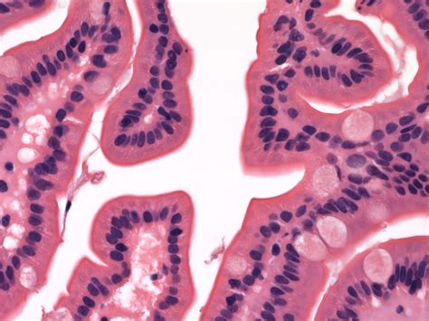 Pathology Outlines - Histology-small intestine