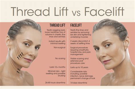 Facelift or Thread Lift?