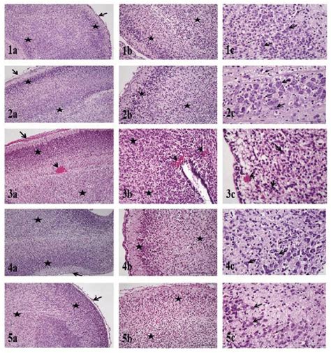 Fetal brain histology. 1a) C group. Pia mater (arrow), neurons and ...