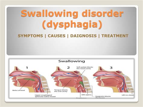 PPT - Swallowing disorder (dysphagia) in children- Causes, Symptoms, Diagnosis and Treatment ...