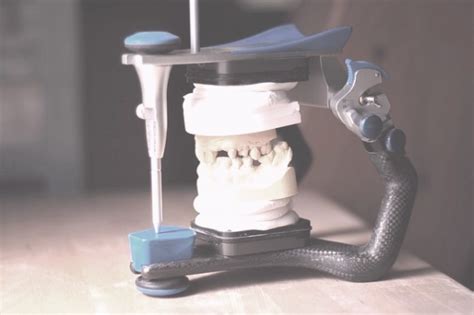 How The Use Of Articulators Simplifies Dental Restoration Process?