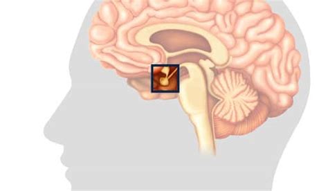 How Does Brain Trauma Affect Brain Hormones? - Elizabeth Sandel, M.D.