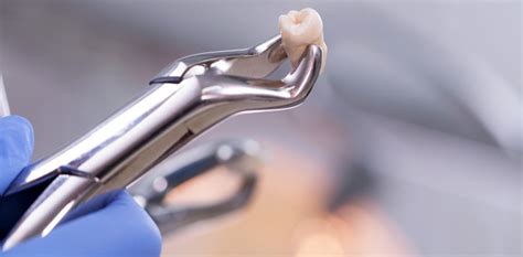 What to do if Your Tooth is Knocked Out | CNS Dental