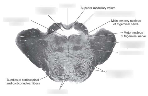 histology - pons at the rostral level Diagram | Quizlet