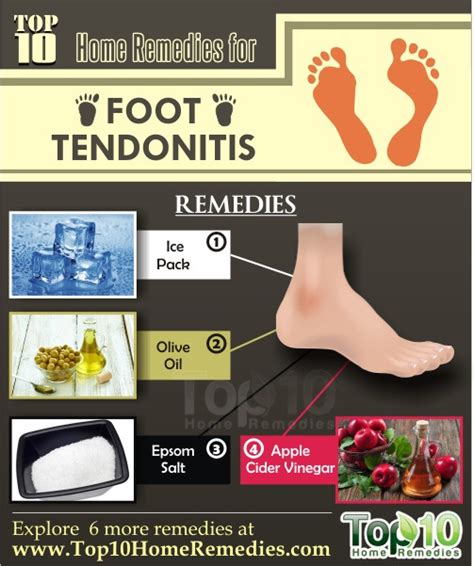 Home Remedies for Foot Tendonitis | Top 10 Home Remedies