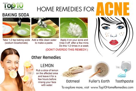 Home Remedies for Acne | Top 10 Home Remedies