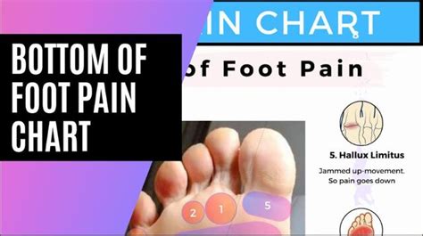 Foot Pain Diagnosis Diagram