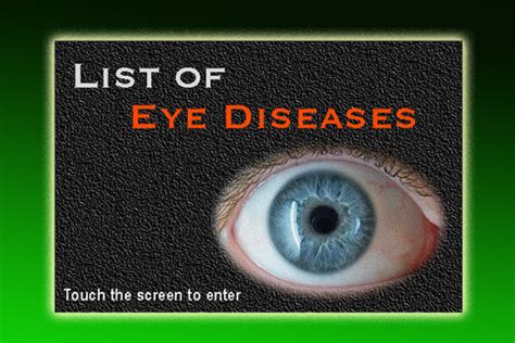 List of Eye Diseases 1.0 App for iPad, iPhone - Medical - app by ...