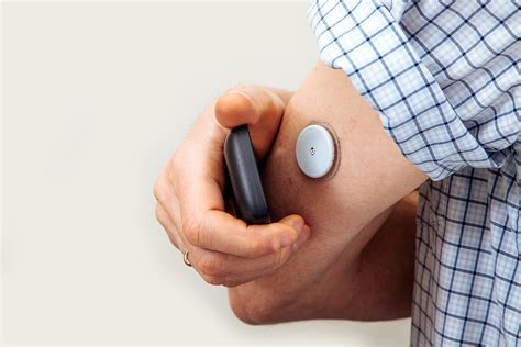 Continuous Glucose Monitoring: Evolving Evidence for Technology - MCG Health