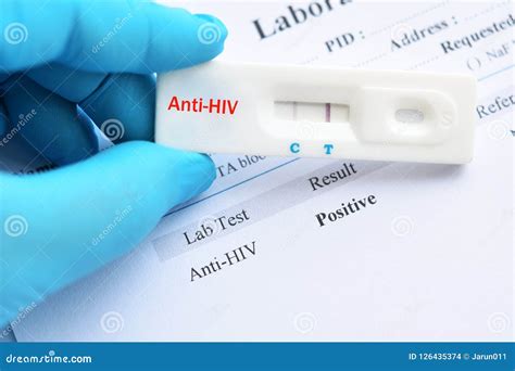 HIV positive test result stock photo. Image of health - 126435374