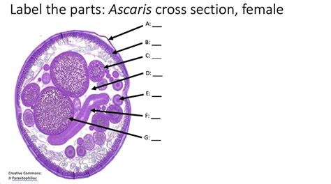 label the parts ascaris cross section female a creative commons parasitophillac 39161