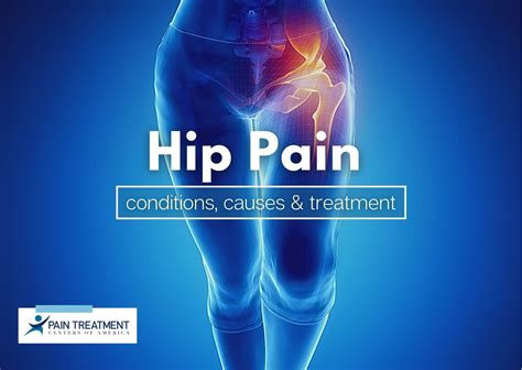 An Overview of Hip Pain: Conditions, Causes & Treatment | PTCOA