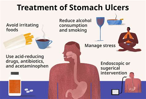 How Do I Know If I Have An Intestinal Ulcer: Signs And Symptoms