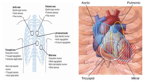 CS 2 CARDIOVASCULAR EXAMINATION The precordium - YouTube