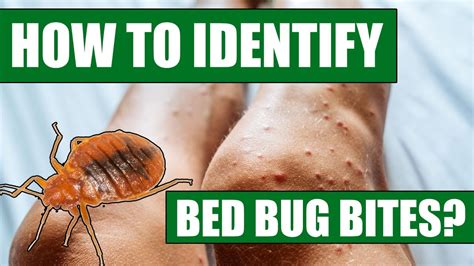 How To Identify Bed Bug Bites