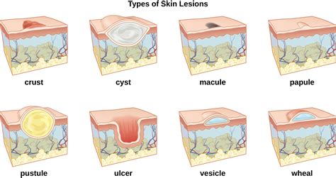 DDX Skin Lesions — HoldingOrders.com