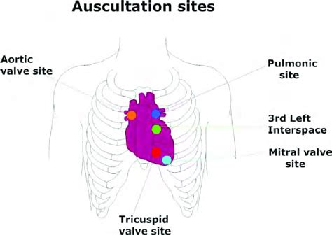 Cardiac Auscultation