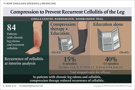 » Compression Therapy for Cellulitis Prevention - Lipedema