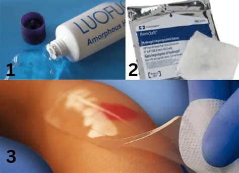 What Is Hydrogel Wound Dressing? See Its 3 Amazing Types ...