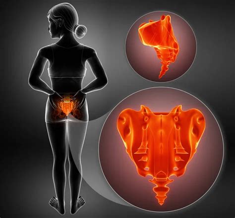 3d illustration of sacrum bone pain Stock Photo by ©pixdesign123 145338761