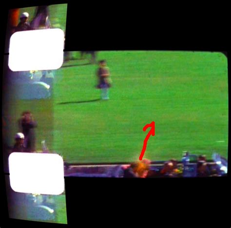 The Fatal Head Shot That Killed JFK