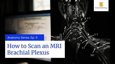 Brachial Plexus Anatomy Mri