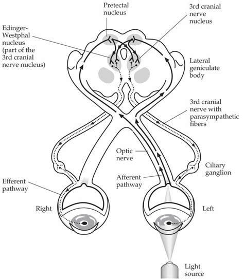 Pupillary light reflex & pupillary light reflex test