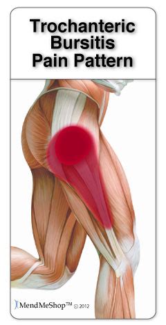 Bursitis Information and Treatments