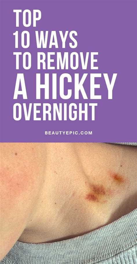 How To Cover Up A Hickey Without Makeup