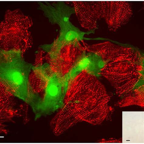 Isolation of c-kit+ cells. C-kit+ cells were isolated by 2 consecutive ...