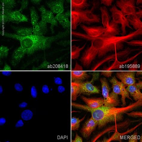 Alexa Fluor® 488 Anti-PAH antibody [EPR12380] (ab208418) | Abcam